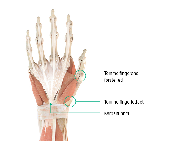 Anatomisk tegning af en hånd: Her kan man se tommelfingerens grundled, tommelfingerens sadelformede led og hvor karpaltunnelen befinder sig