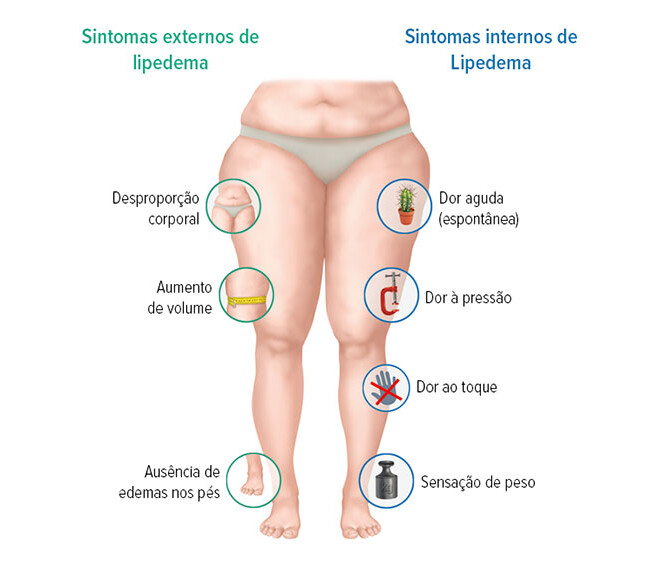 Sintomas do lipedema