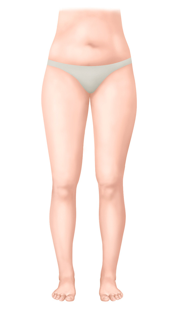 Stadie 0 – Latensstadiet Stadie 0 – Latensstadiet