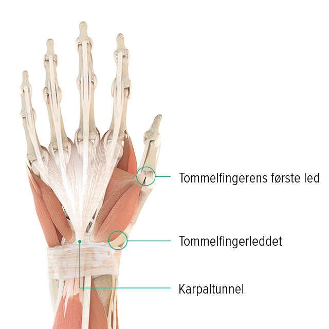 Anatomisk tegning af en hånd: Her kan man se tommelfingerens grundled, tommelfingerens sadelformede led og hvor karpaltunnelen befinder sig
